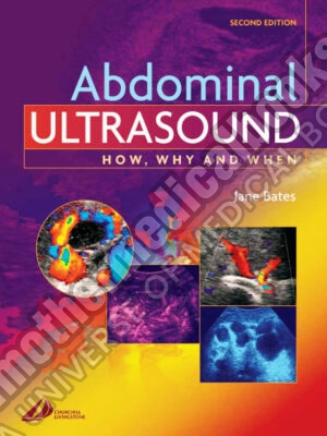 Abdominal Ultrasound How Why and When 2nd second Edition by Bates MPhil DMU DCR Jane A. published by Churchill Livingstone 2004