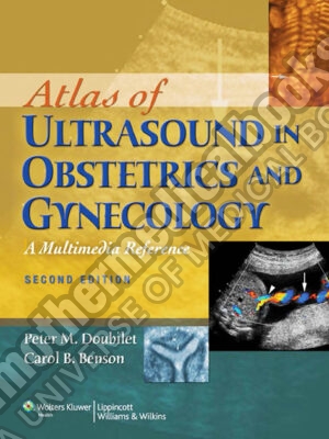 Atlas of Ultrasound in Obstetrics and Gynecology A Multimedia Reference Second 2nd Edition