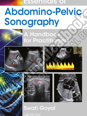 Essentials of Abdomino Pelvic Sonography A Handbook for Practitioners Hardcover