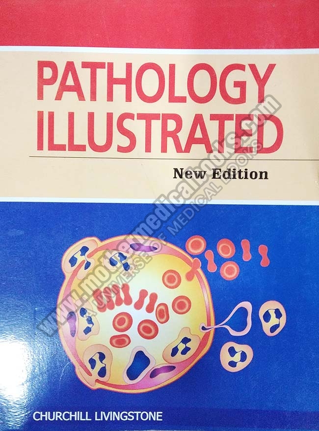 Pathology Illustrated – MotherMedicalBooks.com